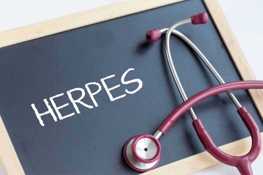 sintomi herpes oculare